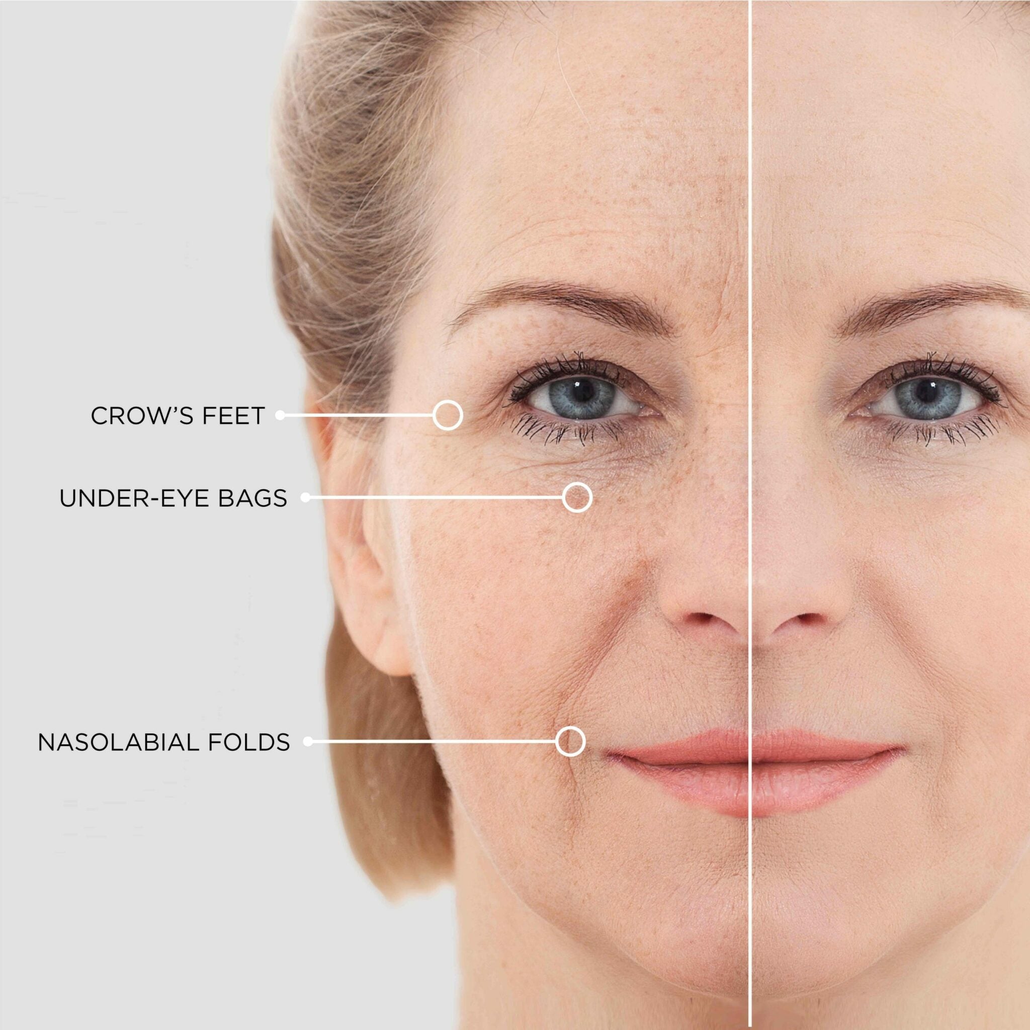 Eye Glow Patches (Buy 1 Get 1 Free)