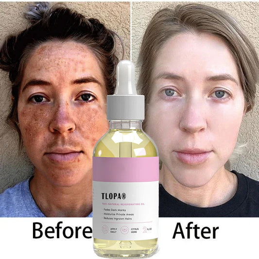 Quickly remove dark spots – moisturizes and removes ingrown hairs to infuse your skin with vitality and radiance.