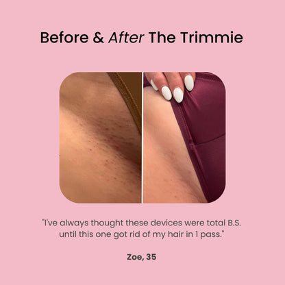 Nuvoran™ 2-in-1 Hair Trimmer